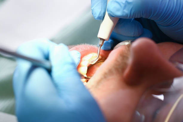 Best Mobile Emergency Dentist in Burleson, TX