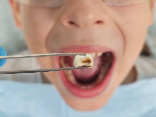Best 24-Hour Emergency Dentist in Burleson, TX